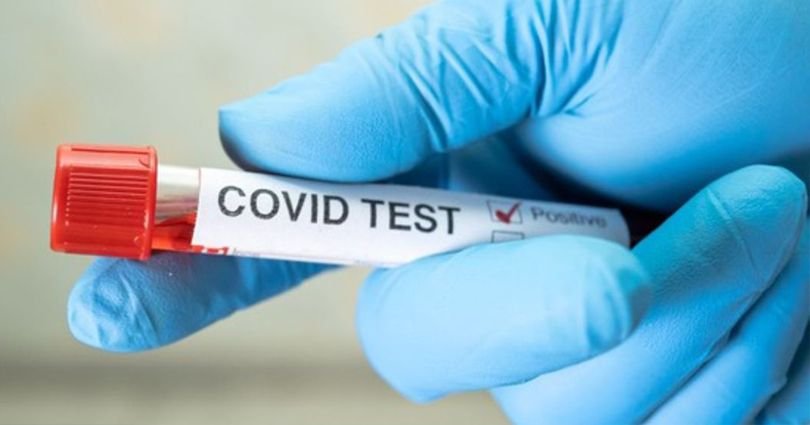 MS mantém estabilidade nos casos de covid-19; Naviraí registra 15 casos na última semana